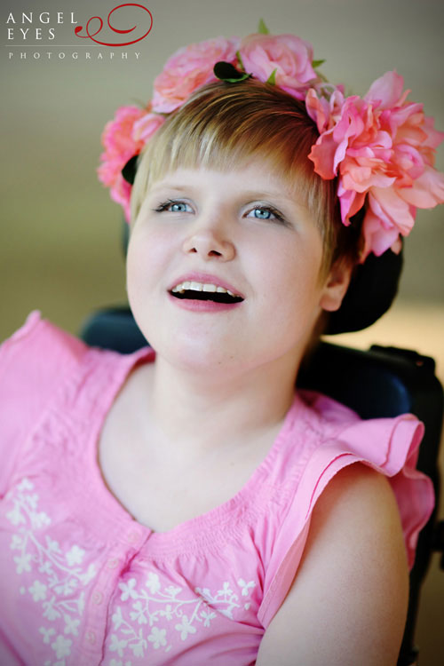 Special needs model, fashion photography,   Chicago portait photographer,  Cortney (7)